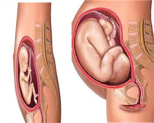 郑州高龄借卵生子,单角子宫对生育的影响